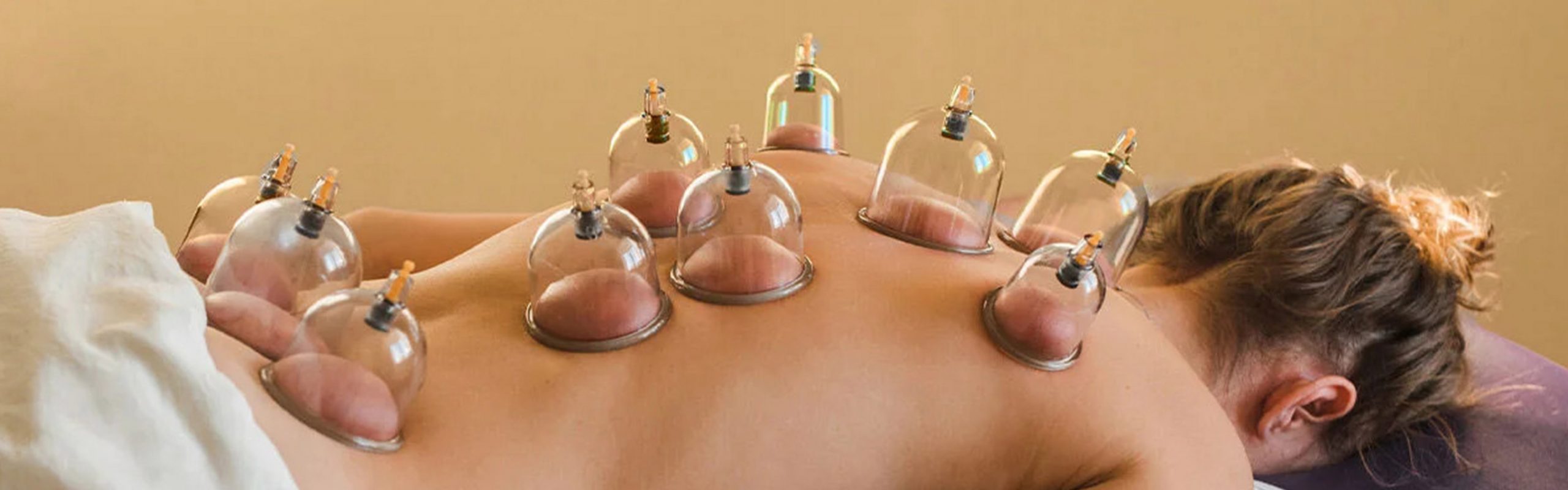 Cupping Techniques